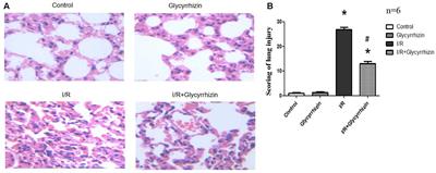 Glycyrrhizin Ameliorate Ischemia Reperfusion Lung Injury through Downregulate TLR2 Signaling Cascade in Alveolar Macrophages